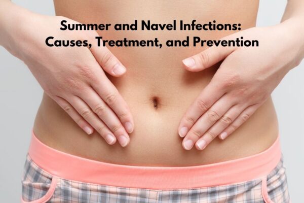 Summer and Navel Infections: Causes, Treatment, and Prevention