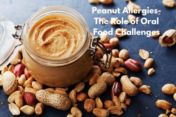 Understanding Peanut Allergies: The Role of Oral Food Challenges