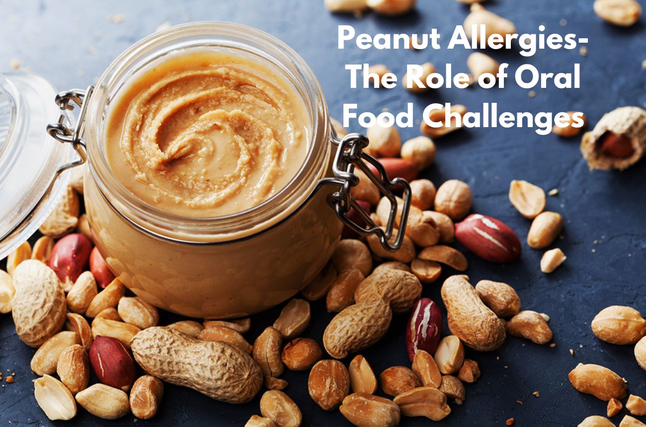 Understanding Peanut Allergies: The Role of Oral Food Challenges